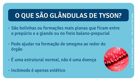 glandulas tyson o que é|Glândulas de Tyson: descubra o que são e sai... 